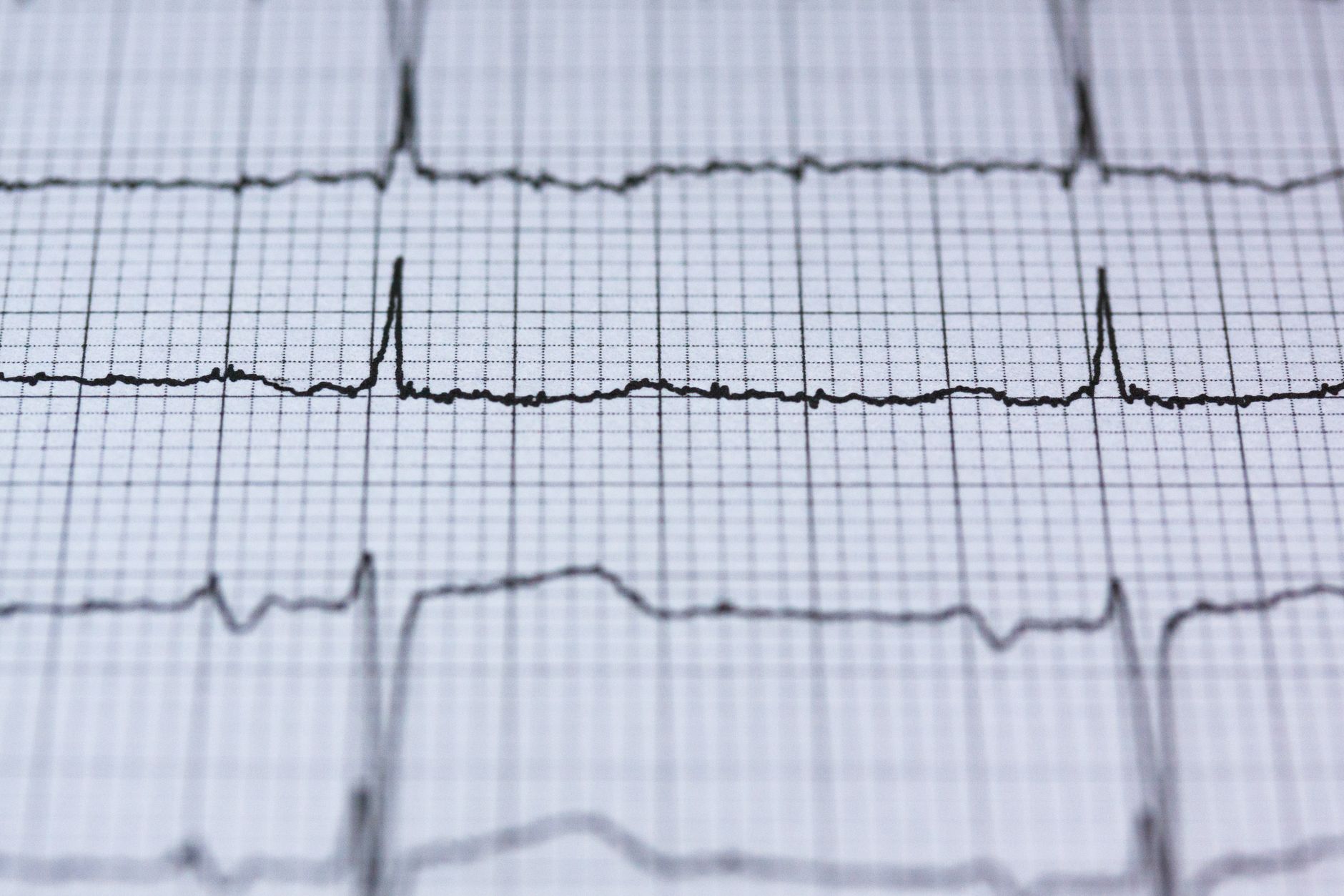 Zbliżenie wydruku EKG z zapisem rytmu serca na papierze milimetrowym